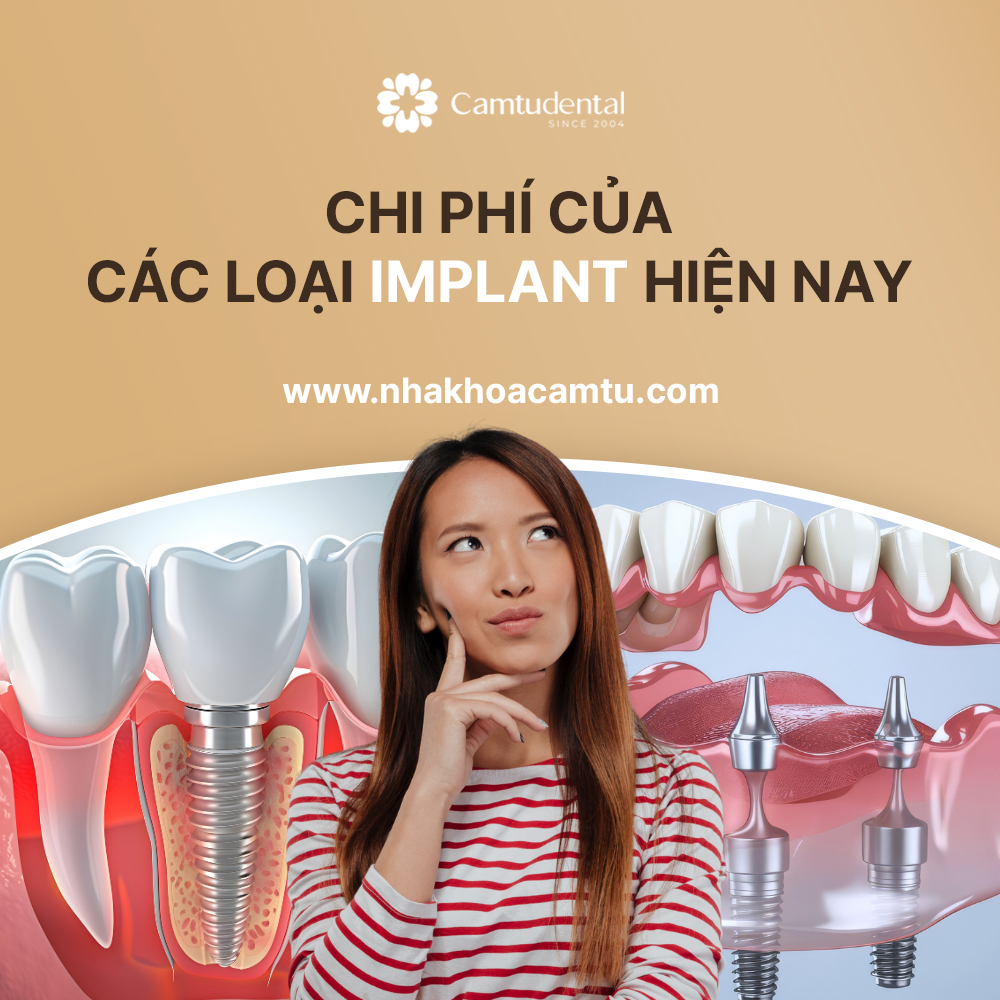 trồng răng implant