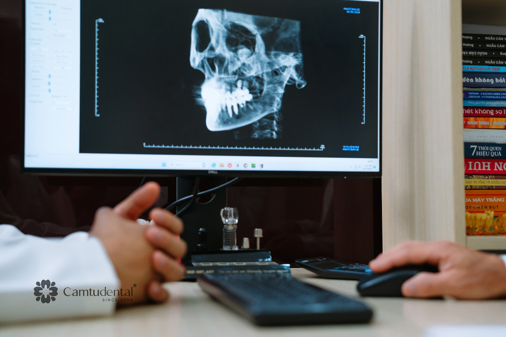 5 dấu hiệu “đáng lẽ phải biết sớm” để không hối hận khi trồng implant 3 Quy trình cấy ghép implant tại Cẩm Tú thường diễn ra như thế nào