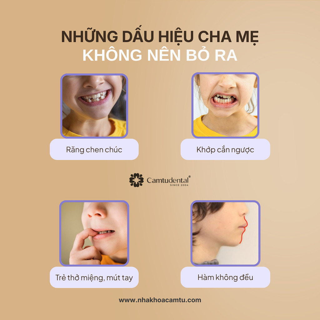 những lưu ý khi niềng răng trẻ em