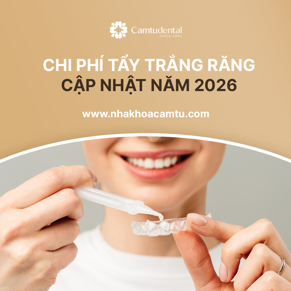 Tẩy trắng răng giá bao nhiêu