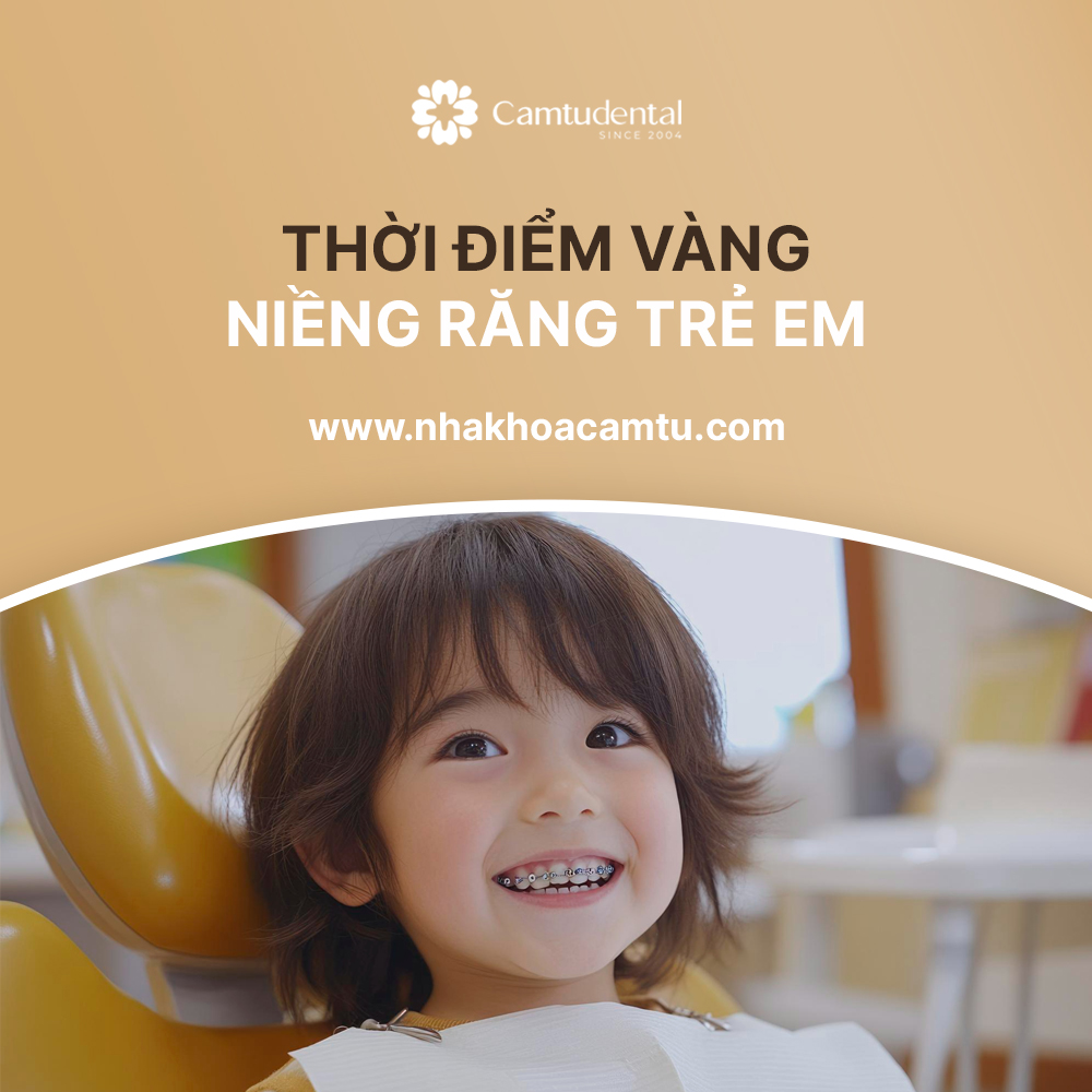 niềng raweng trẻ em