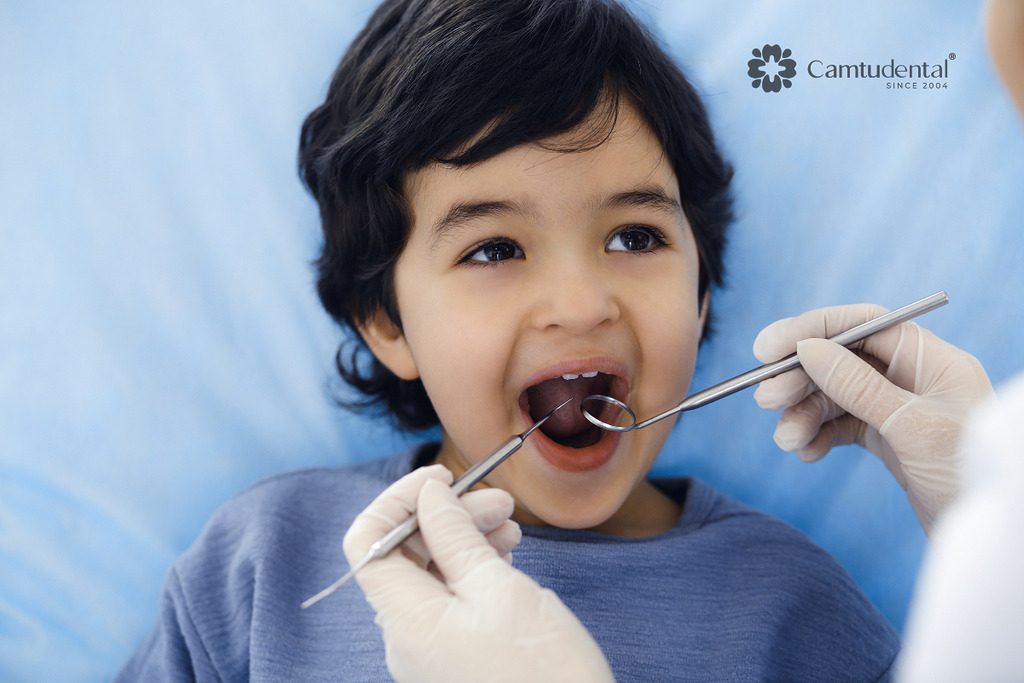 Nhổ răng sữa cho trẻ: Thời điểm và phương pháp tốt nhất 1 Nhổ răng sữa cho trẻ