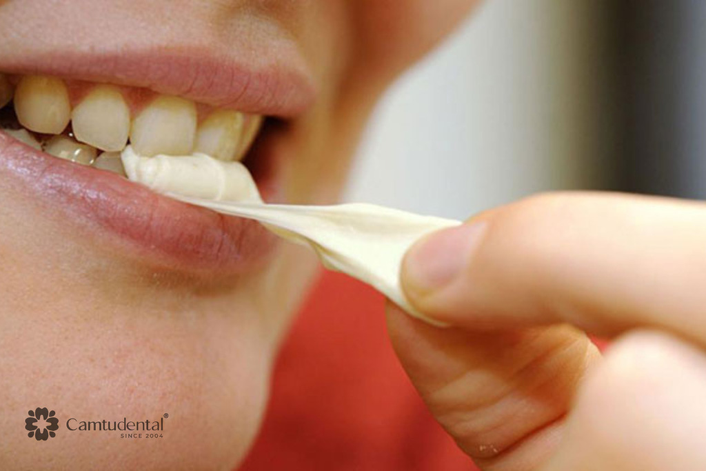Kẹo dính có thể tạo áp lực lên răng sứ khi nhai