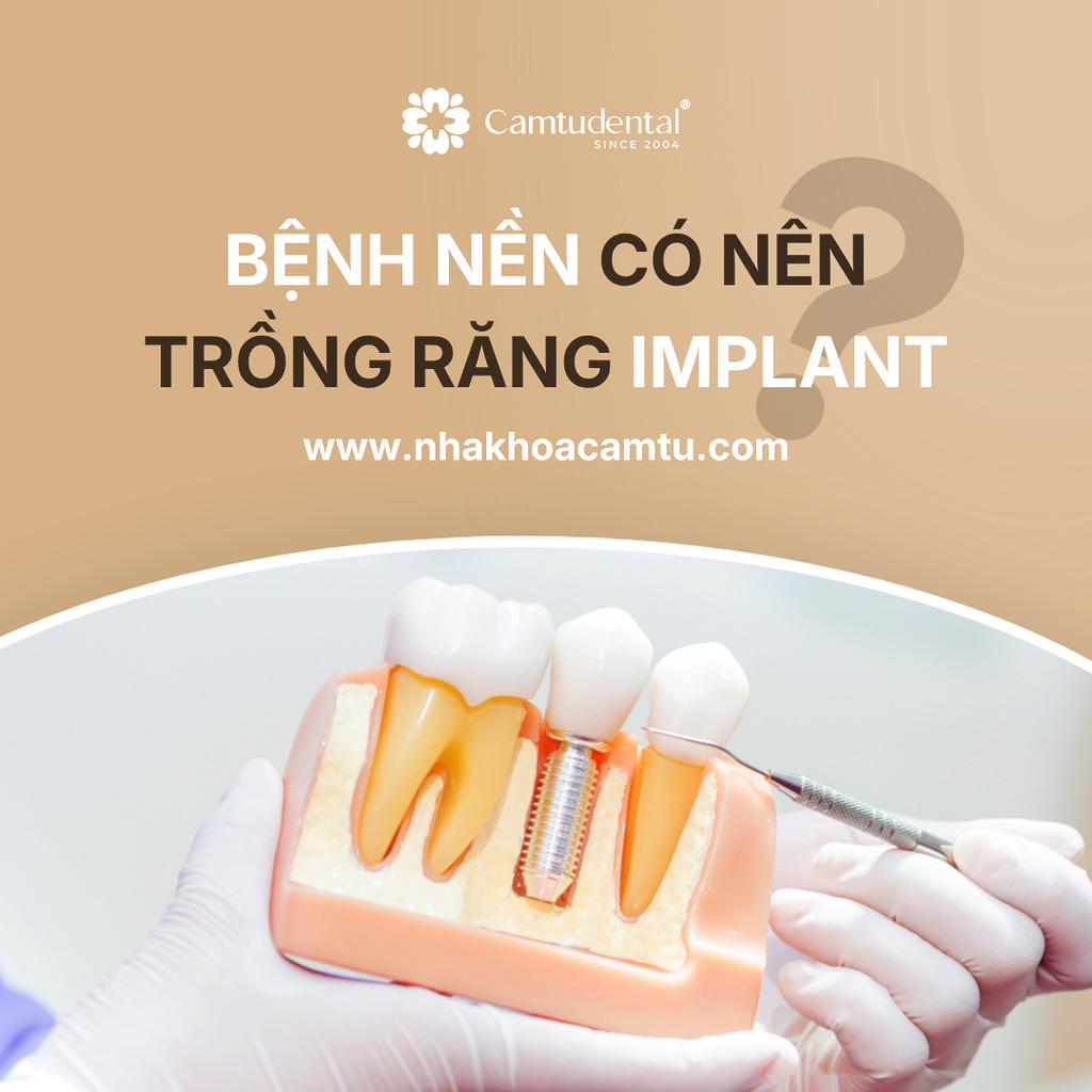 trồng răng implant cho người có bệnh lý nền